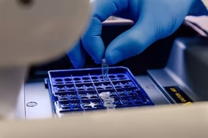 ELISA Kits, Antibodies & Proteins